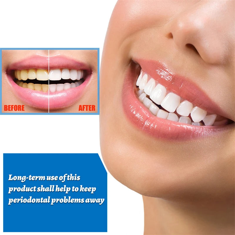 Teeth Whitening Essence Remove Plaque Stains Serum Fresh Breath Oral Hygiene Against Dental Caries Dental Tooth Cleaning Tools Leedoar
