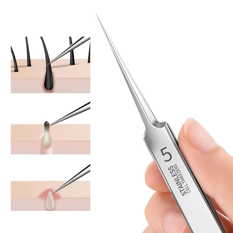 1 Pack Extra Fine No. 5 Cellular Acne Blackhead Tweezers - Facial Beauty Remove Acne Needle Tools for Skin Care Leedoar