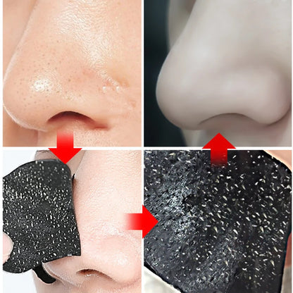 10/20/50 peças tiras de nariz para remoção de cravos e acne tiras de desobstrução instantânea de poros limpeza profunda adesivo de limpeza de nariz novo 