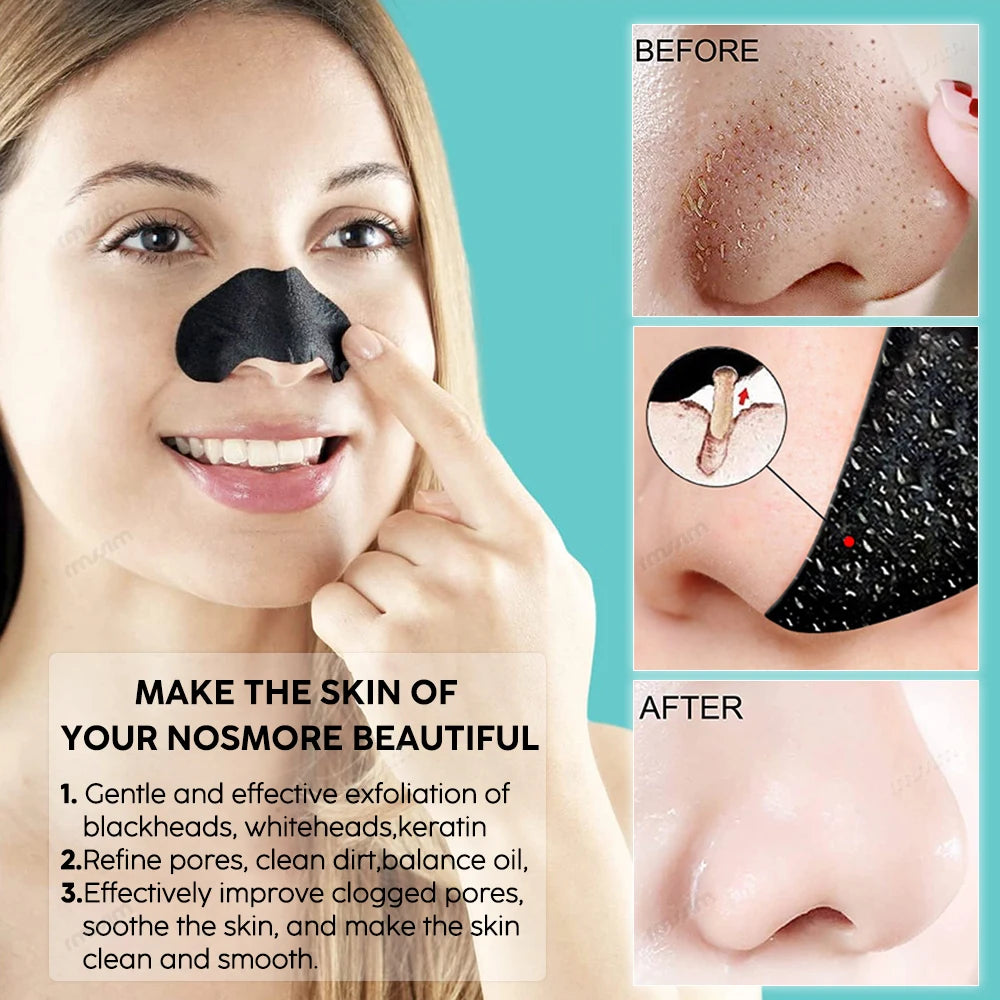 10-50pcs Unisex Blackhead Remove Mask Peel Nasal Strips Deep Cleansing Shrink Pore Nose Black Head Stickers Skin Care Facialmask Leedoar