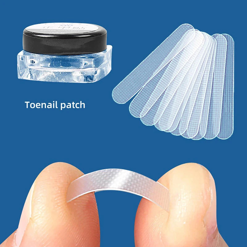 10Pcs Ingrown Toe Nail Treatment Ingrown Toenail Correction Tool Elastic Patch Sticker Straightening Clip Brace Pedicure Tools Leedoar