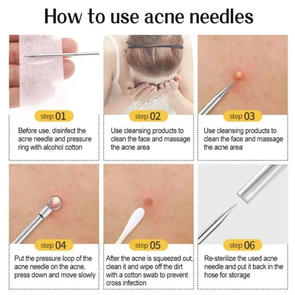 11Pcs Acne Needle Blackhead Clip Remover Extraction Pore Black Head Clean Face Skin Care Cleansing Needle Blemish Removal Tool Leedoar