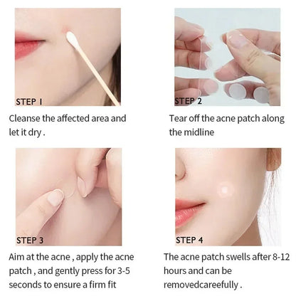 120pcs Invisible Acne Patches Removal Pimple Anti-Acne Hydrocolloid Patches Spots Marks Concealer Repair Sticker Waterproof Leedoar