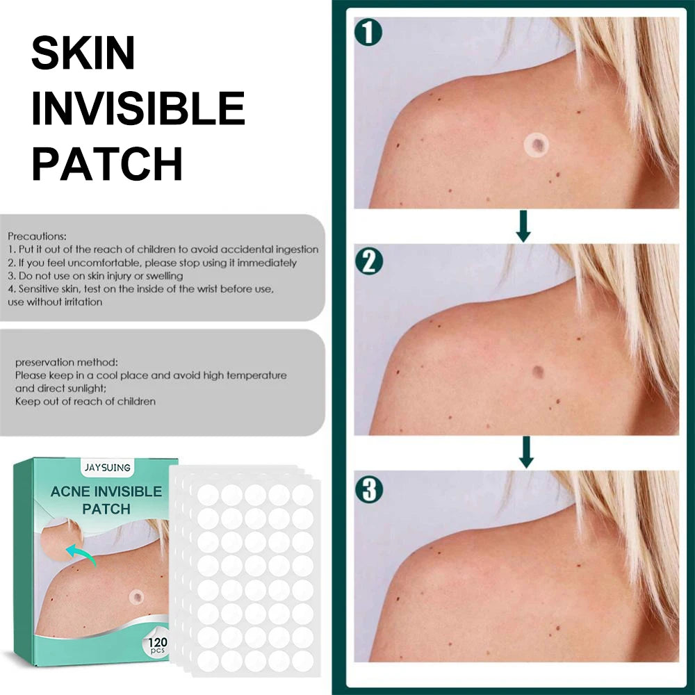 120pcs Invisible Acne Patches Removal Pimple Anti-Acne Hydrocolloid Patches Spots Marks Concealer Repair Sticker Waterproof Leedoar