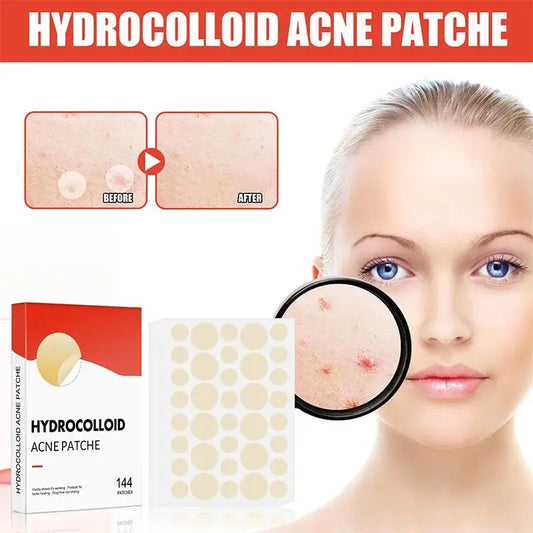 144pcs/set Face Skin Care Acne Pimple Patch 2 Sizes Invisible Professional Healing Absorbing Spot Sticker Covering for Men Women Leedoar