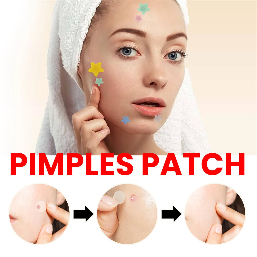 200 Patches Acne Patch Gentle Non-irritating Repair Facial Deep Cleansing Residue-Free Blemish Pimples Invisible Covering Patch Leedoar