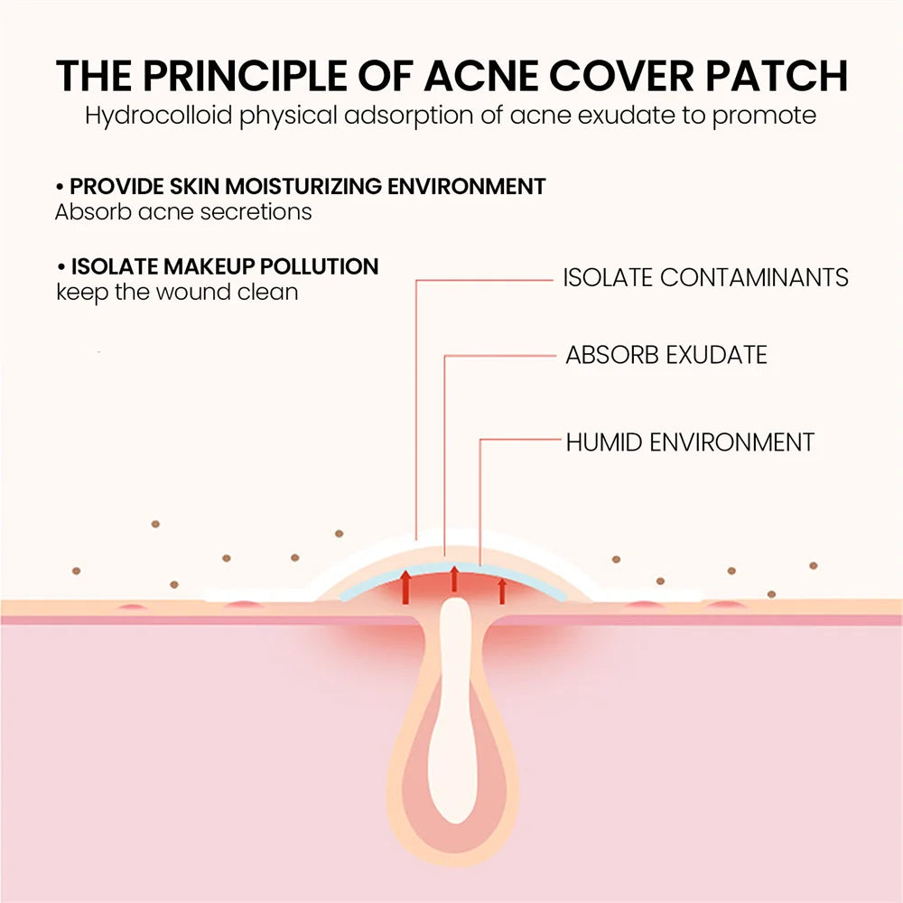 200 Patches Acne Patch Gentle Non-irritating Repair Facial Deep Cleansing Residue-Free Blemish Pimples Invisible Covering Patch Leedoar