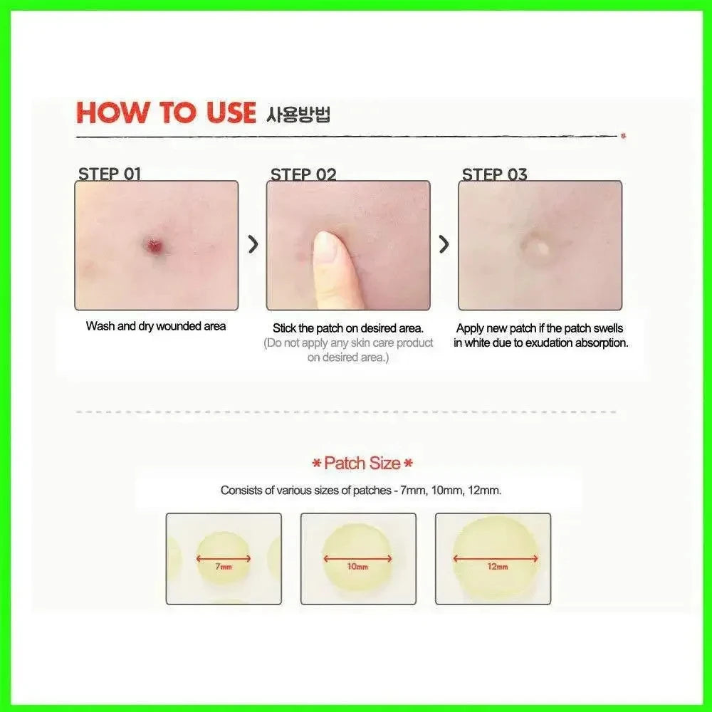 24 peças rosto acne espinha mancha facial cuidados com a pele remoção de cravos sardas adesivos tratamento de cicatrizes máscara de acne beleza 