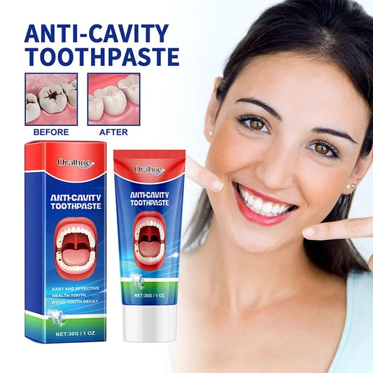 Pasta de dientes anticaries de 30 g Crema reparadora de caries dental Previene la caries Elimina el sarro Protege los dientes Refresca el aliento 