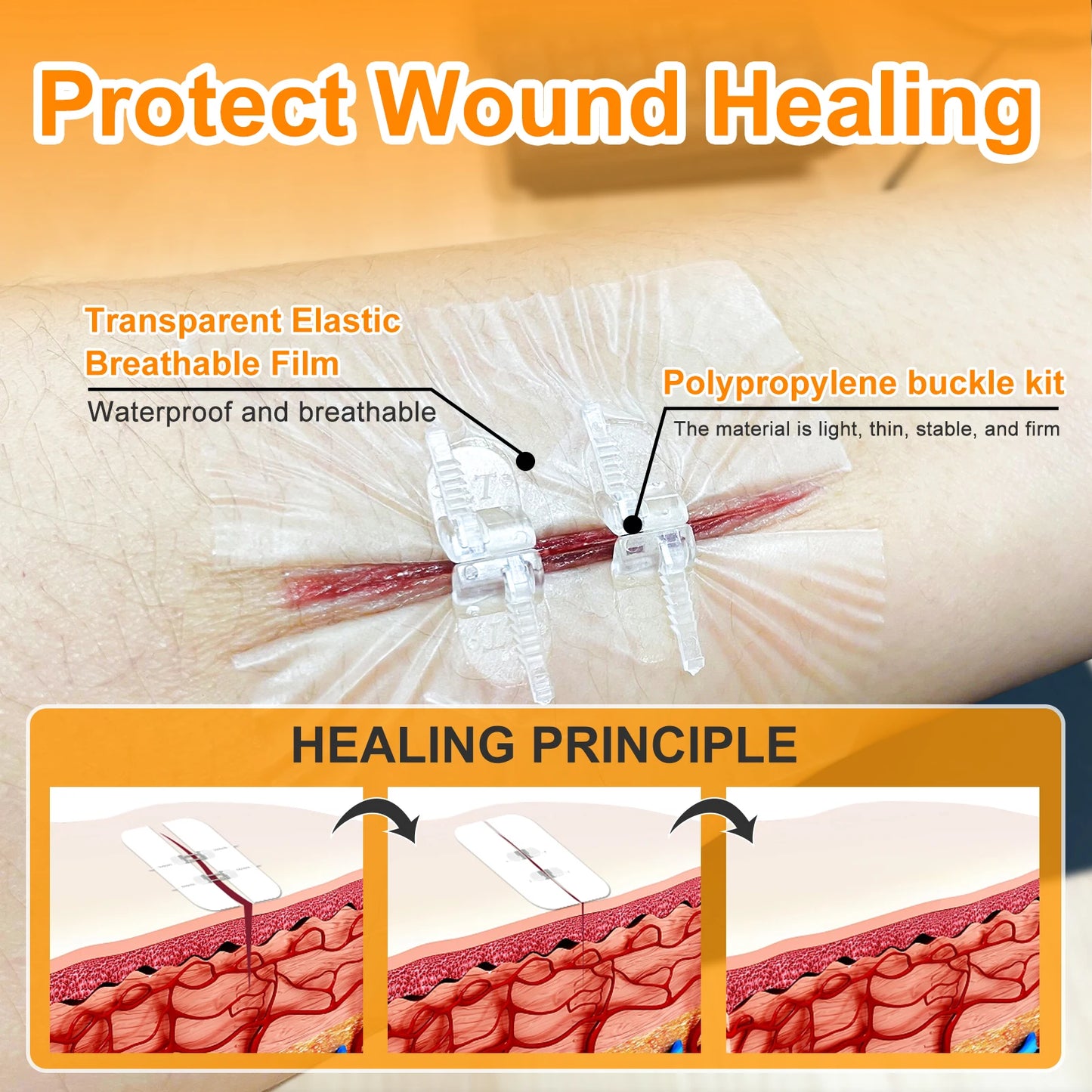 CARBOU 2PCS Zipper Painless Wound Closure Device Suture-free Wound Dressing Closure Strips Kit Emergency Laceration Closures Leedoar