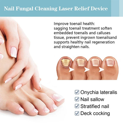 Fungal Nail Laser Repair Device Fast Nails Fungus Onychomycosis Repair Toenail Fingernail Removes Nail Fungus Foot Care Device Leedoar