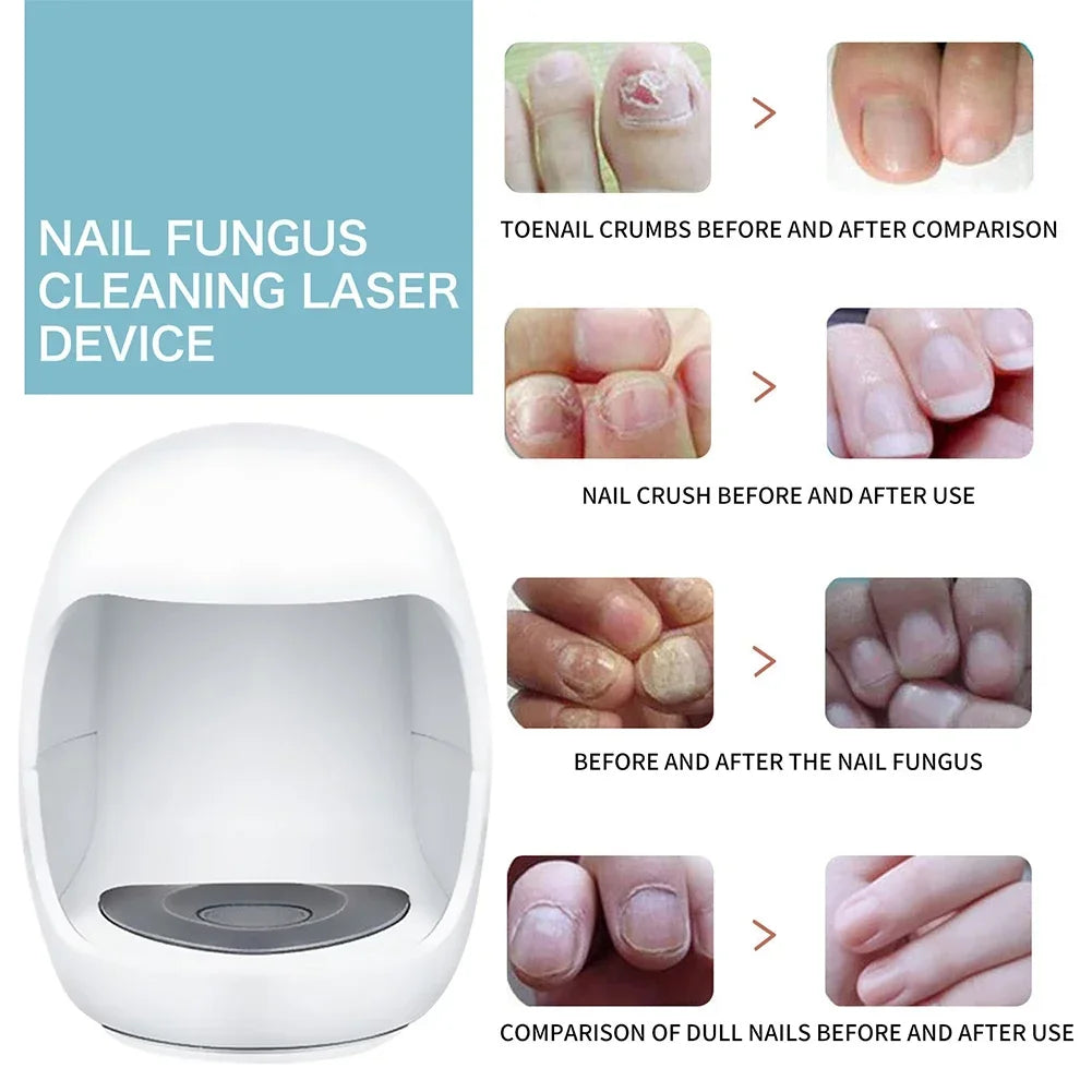 Fungal Nail Laser Repair Device Fast Nails Fungus Onychomycosis Repair Toenail Fingernail Removes Nail Fungus Foot Care Device Leedoar