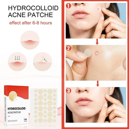 Hydrocolloid Acne Patch Invisible Closed Acne Patch Invisible Acne Face Invisible Waterproof Breathable Acne Skin Patch Leedoar