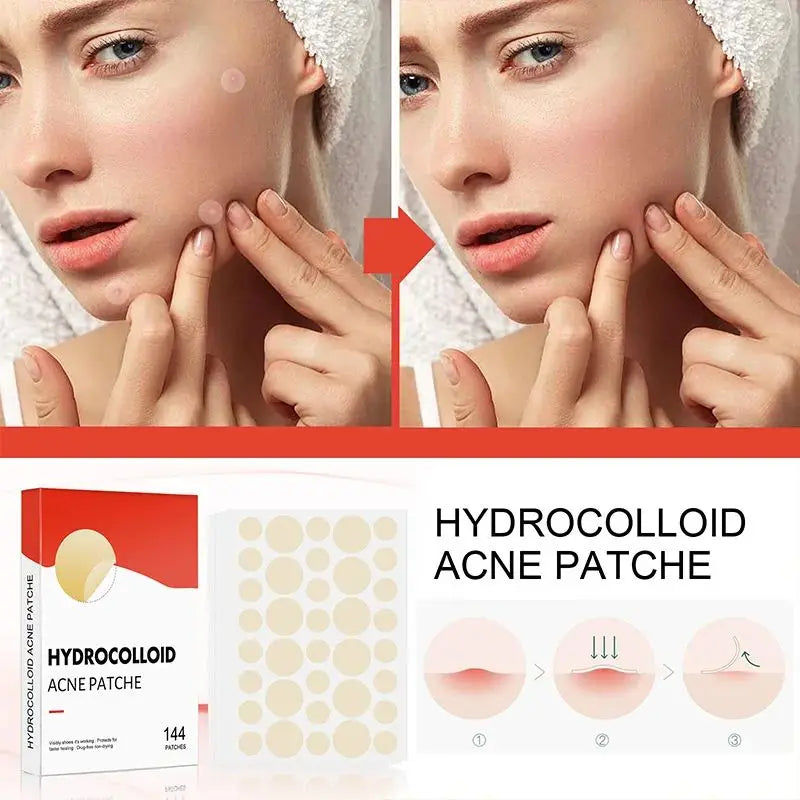 Hydrocolloid Acne Patch Invisible Closed Acne Patch Invisible Acne Face Invisible Waterproof Breathable Acne Skin Patch Leedoar