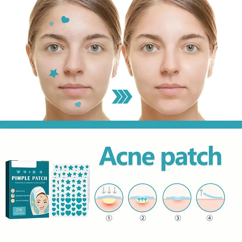 Hydrocolloid Acne Patch Repair Acne Cleansing Invisible Breathable Waterproof Acne Cleansing Concealer Fade Clean Leedoar