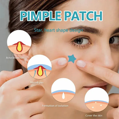 Hydrocolloid Acne Patch Repair Acne Cleansing Invisible Breathable Waterproof Acne Cleansing Concealer Fade Clean Leedoar