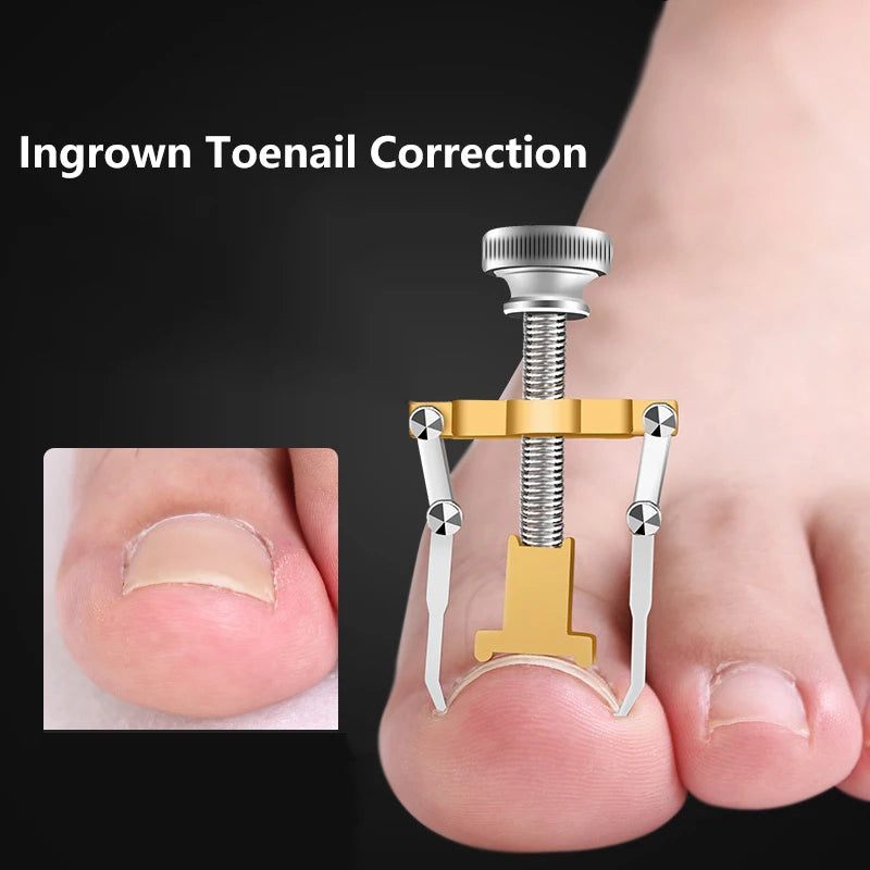 Medical Ingrown Toenail Correction Brace Kit Professional Toe Nail Care Pedicure Manicure Clipper Fixer Recover Corrector Tool Leedoar