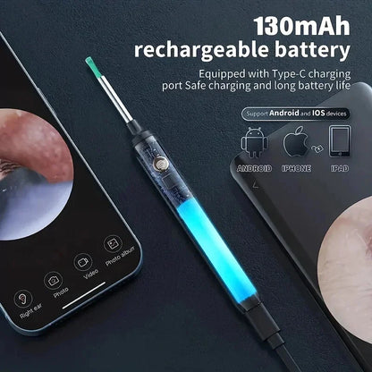 Limpiador de oídos inteligente con pantalla de 1296P, palillos para los oídos, otoscopio, endoscopio con carga USB C, herramienta para eliminar la cera, minicámara para los oídos, kit para el cuidado de la salud 