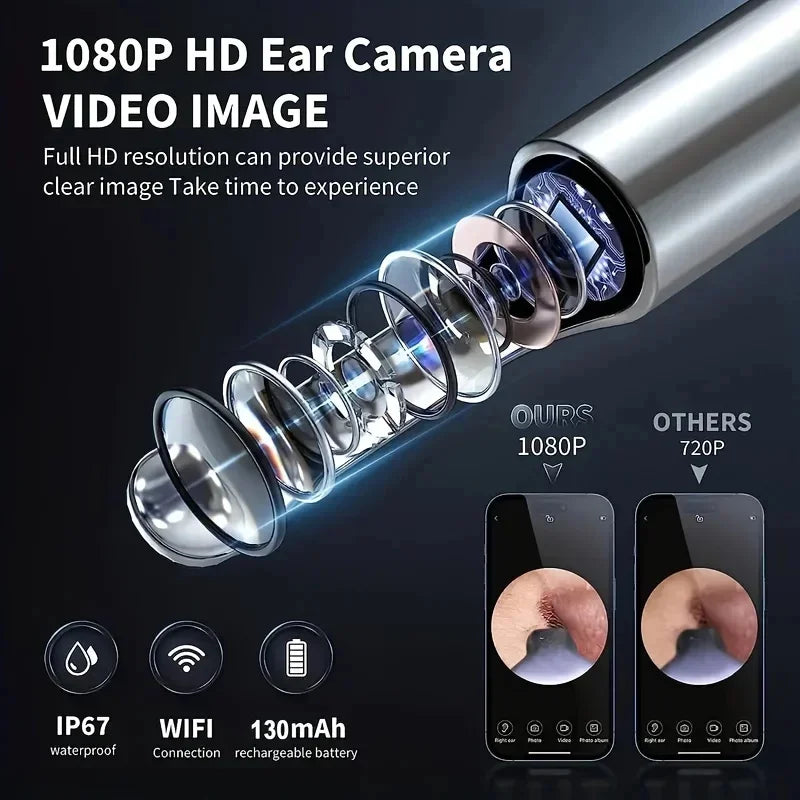 Limpador de ouvido visual inteligente 1296P Ear Sticks Otoscópio USB C Carregamento Endoscópio Ferramenta de remoção de cera Earpick Mini Camera Conjunto de cuidados de saúde 