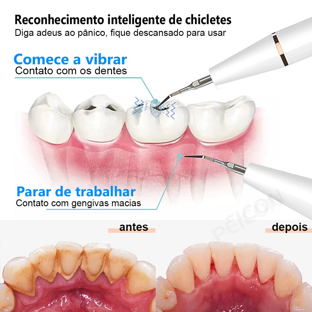 Ultrasonic Dental Scaler For Teeth Tartar Stain Tooth Calculus Remover Electric Sonic Teeth Plaque Cleaner Dental Stone Removal Leedoar