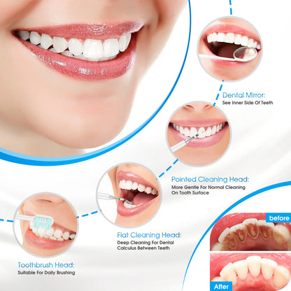 Ultrasonic Electric Sonic Dental Scaler