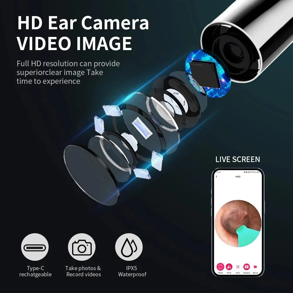 Wireless Ear Cleaner With Camera 6 LED Lights 3.6mm Lens Ear Wax Removal Tool Camera Take Video Photos HD Earpick Gifts Leedoar