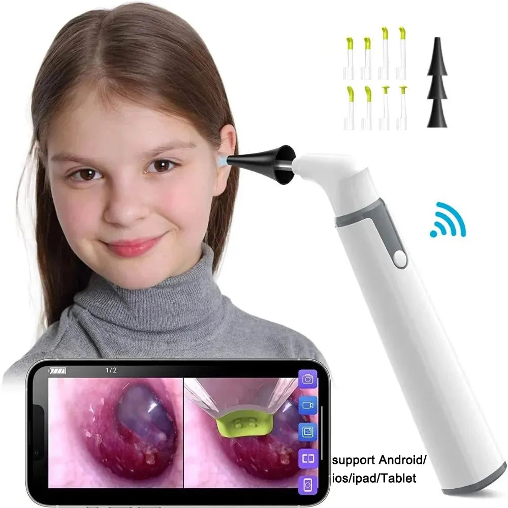 Wireless Otoscope Ear Camera 3.9mm 1080P HD WiFi Ear Scope with 6 LED Lights for Kids and Adults Support Android and iPhone Leedoar