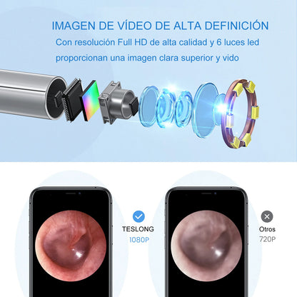 Wireless Otoscope Ear Camera 3.9mm 1080P HD WiFi Ear Scope with 6 LED Lights for Kids and Adults Support Android and iPhone Leedoar