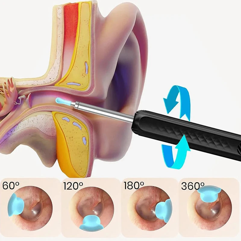 Wireless WiFi Ear Pick Otoscope Camera Borescope Luminous Ear Wax Cleaning Teeth Oral Inspection Health Care Ear Cleaner Kit Leedoar