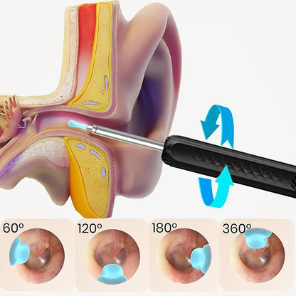 Wireless WiFi Ear Pick Otoscope Camera Borescope Luminous Ear Wax Cleaning Teeth Oral Inspection Health Care Ear Cleaner Kit Leedoar